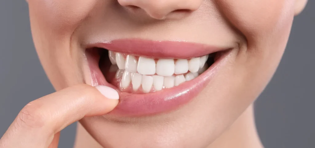 soins gencives detartrage rennes Parodontite : la maladie des gencives Cabinet dentaire NACRE, Dentistes à Saint-Jacques-de-la-Lande