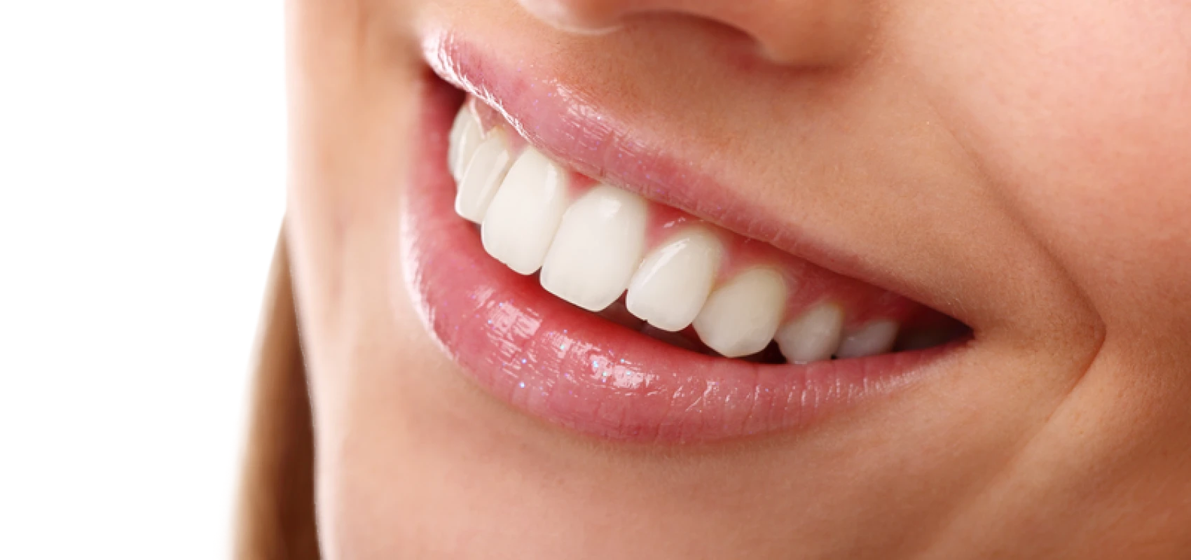 traitement esthetique dentaire