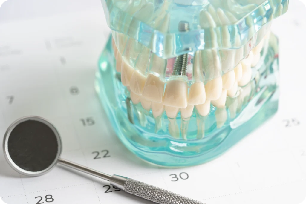 dentiste chateaubriant implant dentaire dentiste chateaubriant implant dentaire Dentiste à Châteaubriant Cabinet dentaire NACRE, Dentistes à Saint-Jacques-de-la-Lande